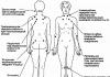 Bolne tačke na ljudskom tijelu: detaljan dijagram i video trening Bolne tačke na ljudskom vratu