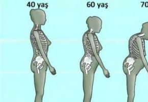 How to treat postmenopausal osteoporosis?