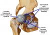 Строение вертлужной впадины тазовой кости и особенности лечения заболеваний Лечение травм тазобедренного сустава